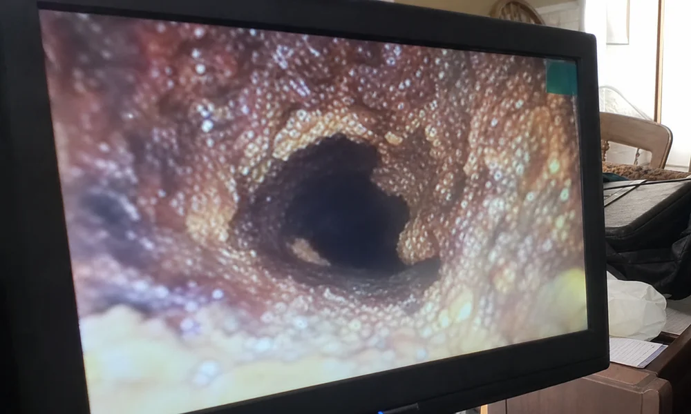 Glazed creosote deposits deep inside a chimney flue revealed by video scan